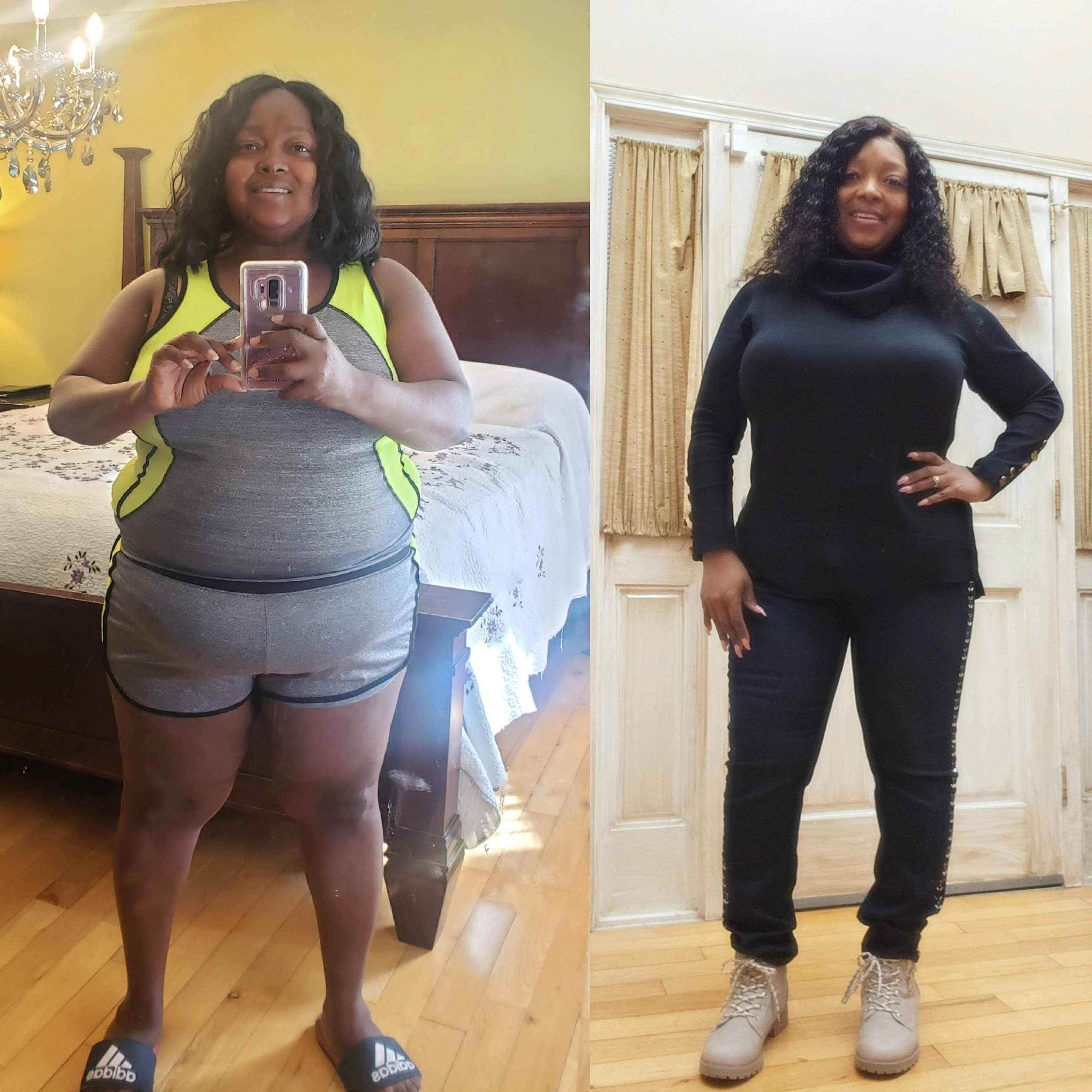 Before & After 2