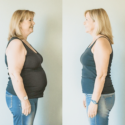 Before & After 3